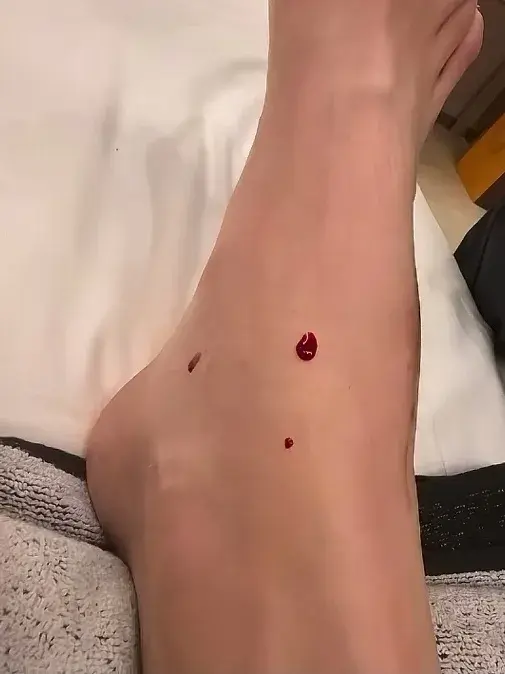 就她往网前, 有利的事情